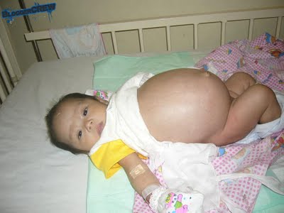 Bayi dua bulan mengandung. Image dari kezoom blogspot